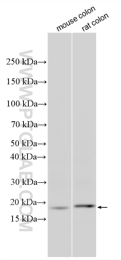 Western Blot (WB) analysis of various lysates using Claudin 1 Recombinant monoclonal antibody (87782-2-RR)