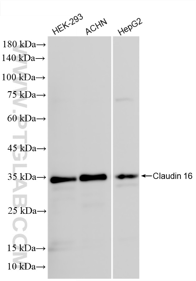 Western Blot (WB) analysis of various lysates using Claudin 16 Recombinant monoclonal antibody (82954-2-RR)