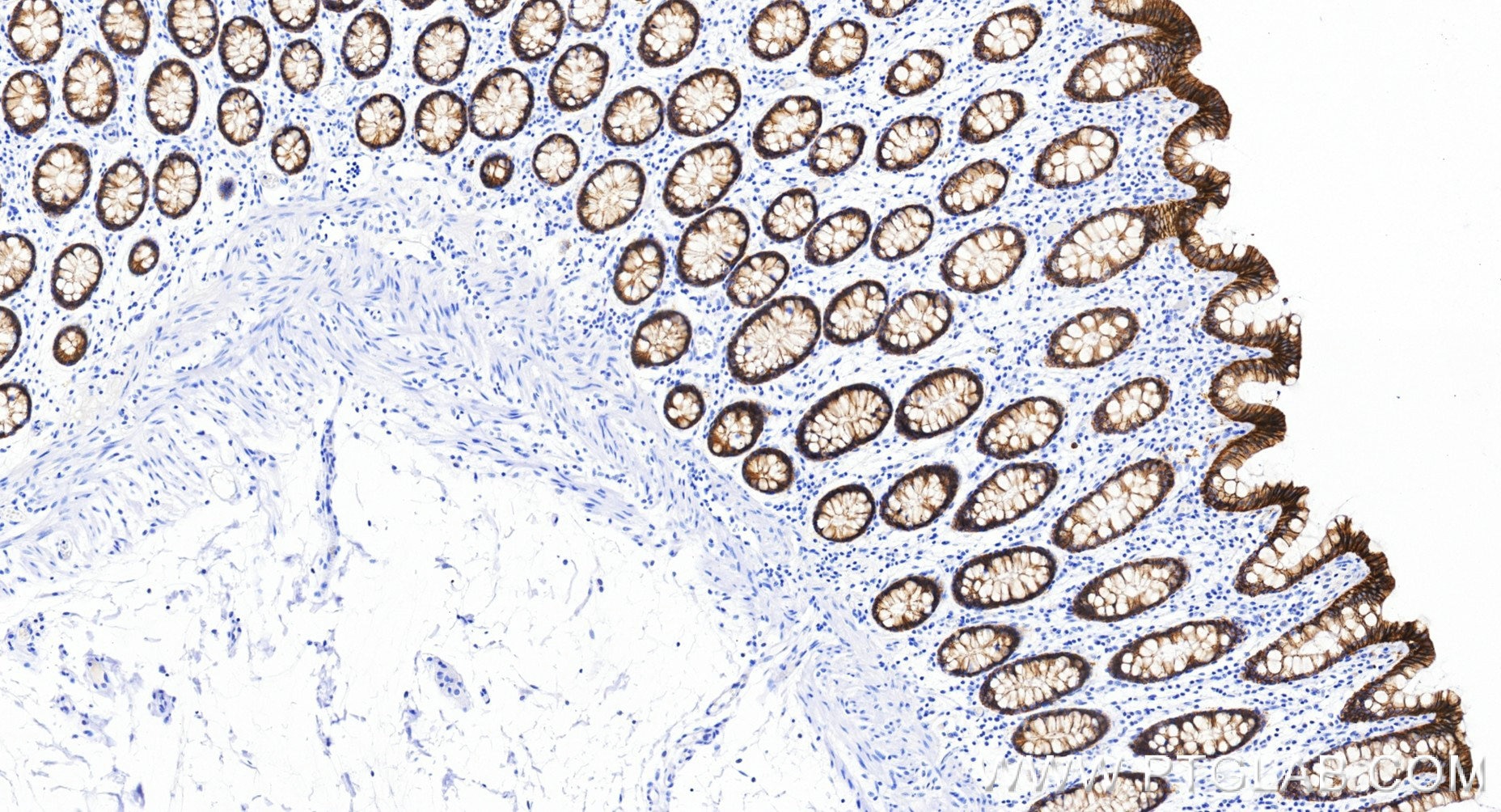 IHC staining of human colon using 86433-8-RR (same clone as 86433-8-PBS) Immunohistochemistry (IHC) staining of human colon tissue using Claudin 4 Recombinant monoclonal antibody (86433-8-RR)