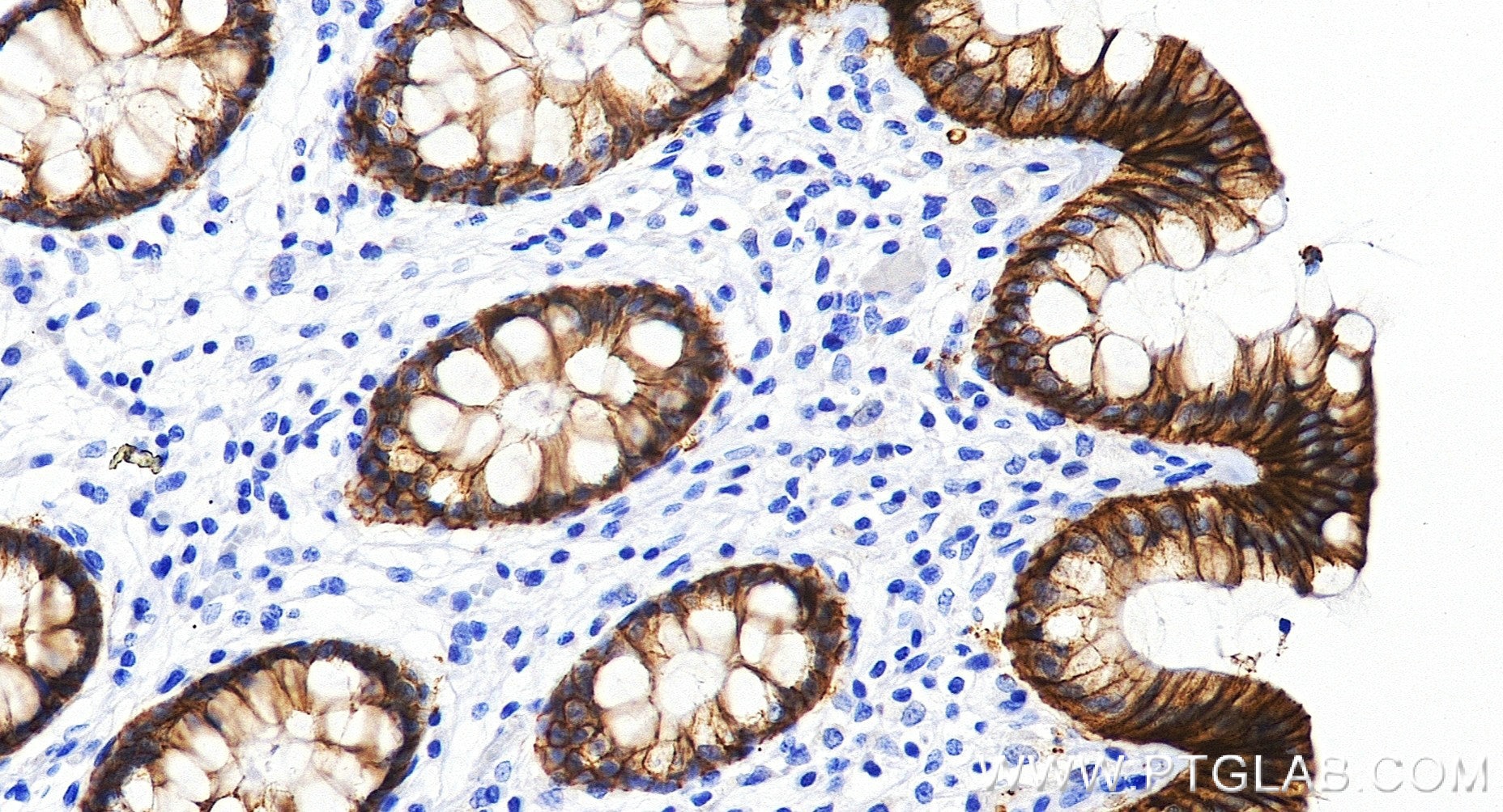 IHC staining of human colon using 86433-8-RR (same clone as 86433-8-PBS) Immunohistochemistry (IHC) staining of human colon tissue using Claudin 4 Recombinant monoclonal antibody (86433-8-RR)