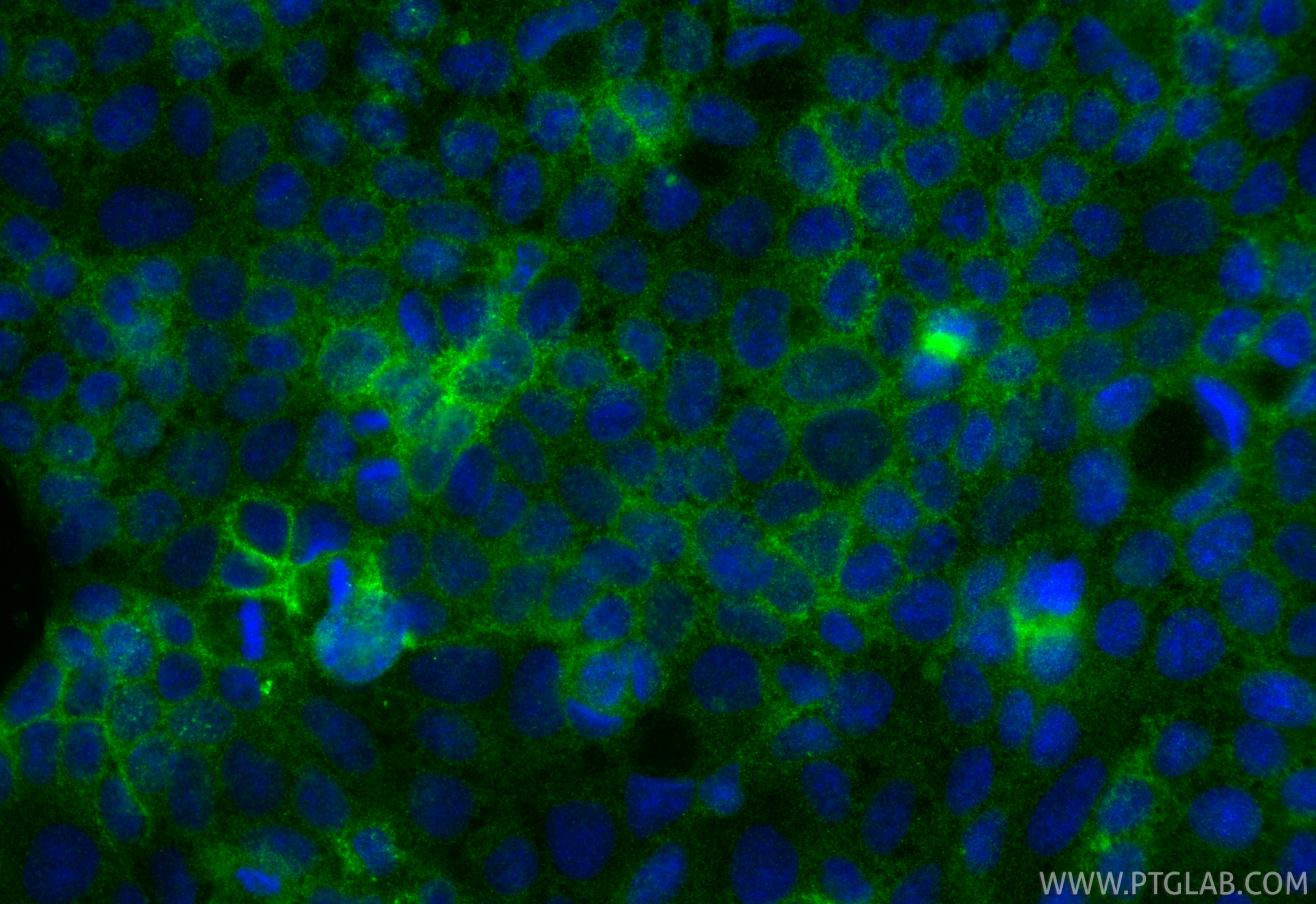 IF Staining of Caco-2 using 86433-8-RR (same clone as 86433-8-PBS) Immunofluorescence (IF) / fluorescent staining of Caco-2 cells using Claudin 4 Recombinant monoclonal antibody (86433-8-RR)