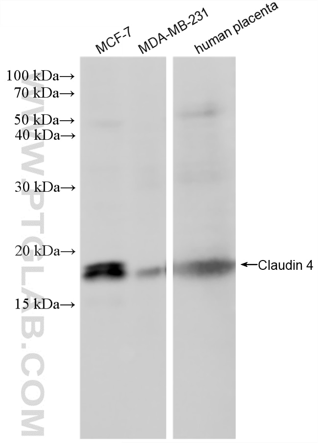 WB analysis using 86433-8-RR (same clone as 86433-8-PBS) Western Blot (WB) analysis of various lysates using Claudin 4 Recombinant monoclonal antibody (86433-8-RR)