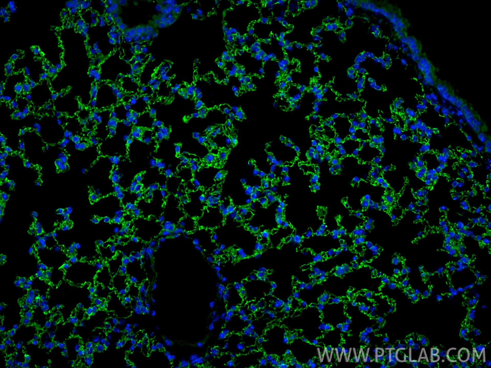 Immunofluorescence (IF) / fluorescent staining of mouse lung tissue using Claudin 5 Polyclonal antibody (29767-1-AP)