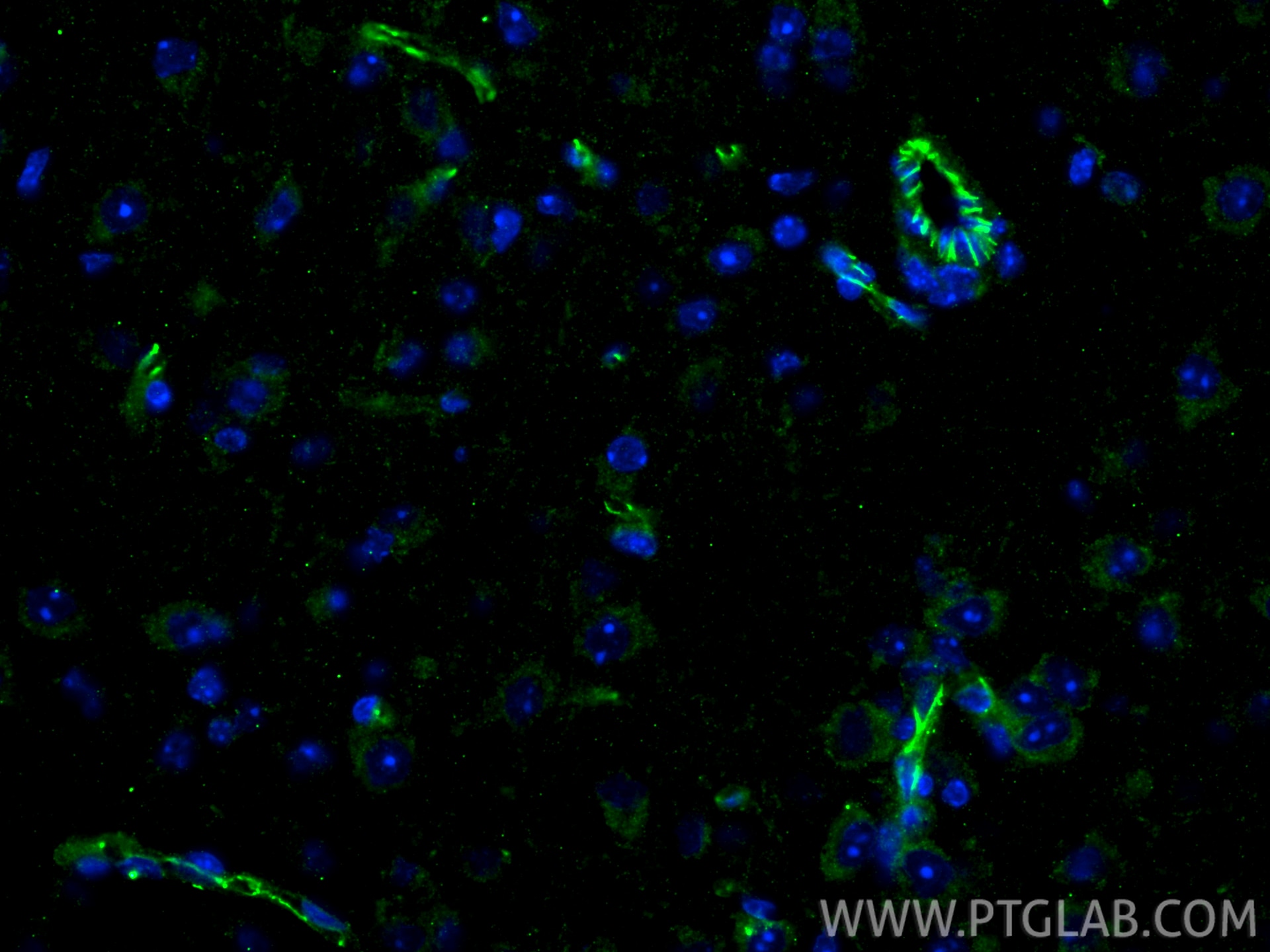 IF Staining of mouse brain using 29767-1-AP Immunofluorescence (IF) / fluorescent staining of mouse brain tissue using Claudin 5 Polyclonal antibody (29767-1-AP)