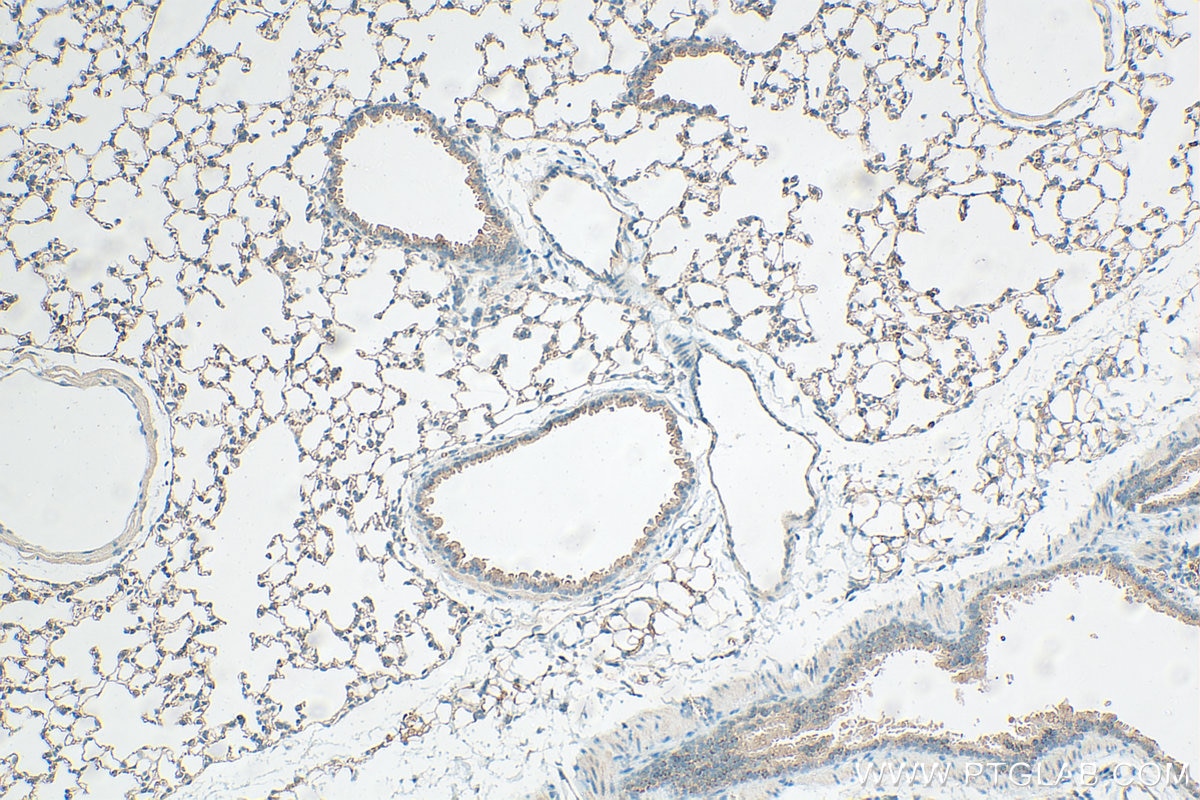 Immunohistochemistry (IHC) staining of mouse lung tissue using Claudin 5 Polyclonal antibody (29767-1-AP)