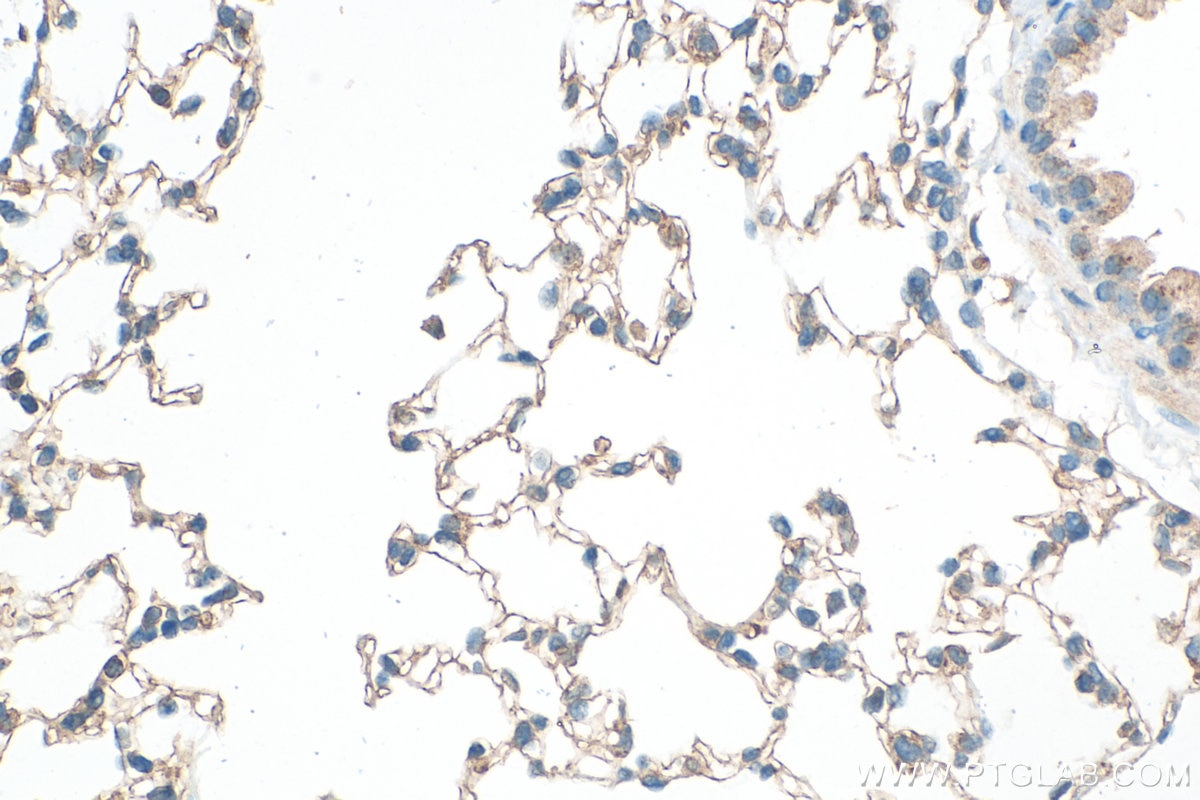 Immunohistochemical analysis of paraffin-embedded mouse lung tissue slide using 29767-1-AP (Claudin 5 antibody) at dilution of 1:800 (under 40x lens). Heat mediated antigen retrieval with Tris-EDTA buffer (pH 9.0). Immunohistochemistry (IHC) staining of mouse lung tissue using Claudin 5 Polyclonal antibody (29767-1-AP)