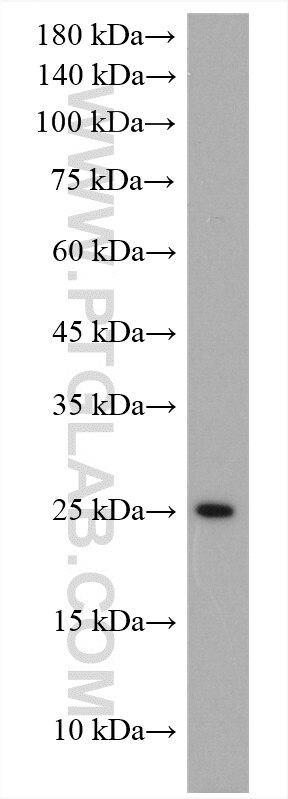 WB analysis of mouse lung using 17738-1-AP