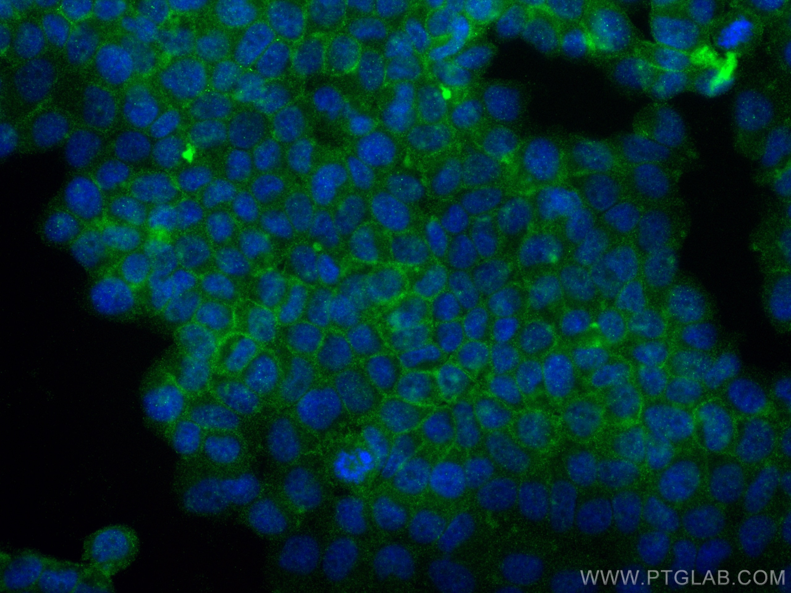 Immunofluorescence (IF) / fluorescent staining of T-47D cells using Claudin 9 Polyclonal antibody (30520-1-AP)