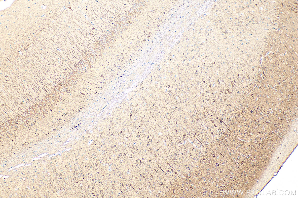 Cleaved Caspase 3/P17/P19