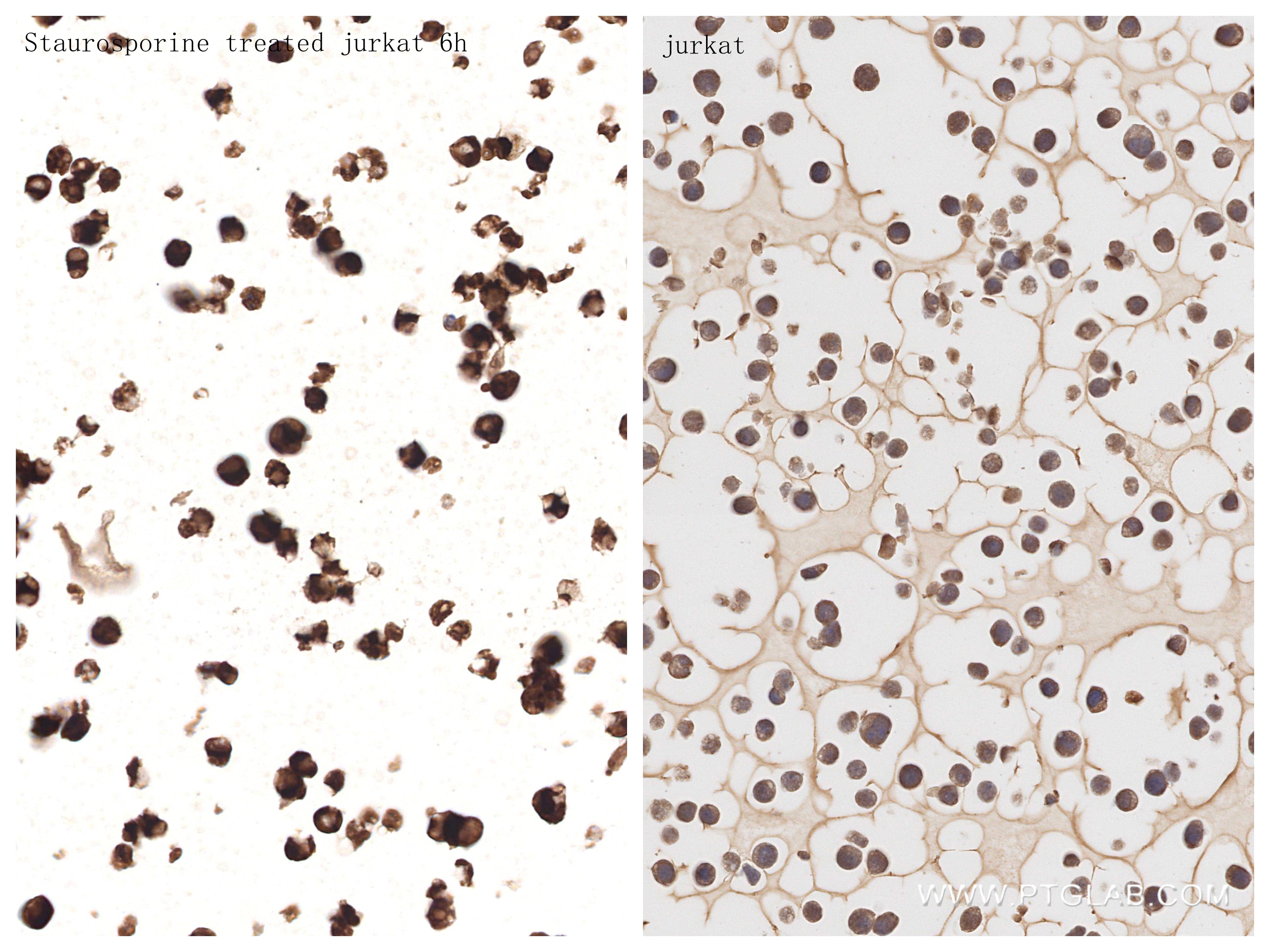 Immunohistochemical analysis of paraffin-embedded Jurkat cells slide using 82707-13-RR (Cleaved Caspase 3/P17/P19 antibody) at dilution of 1:2000 (under 40x lens). Heat mediated antigen retrieval with Tris-EDTA buffer (pH 9.0). Immunohistochemistry (IHC) staining of Jurkat cells using Cleaved Caspase 3/P17/P19 Recombinant monoclonal a (82707-13-RR)