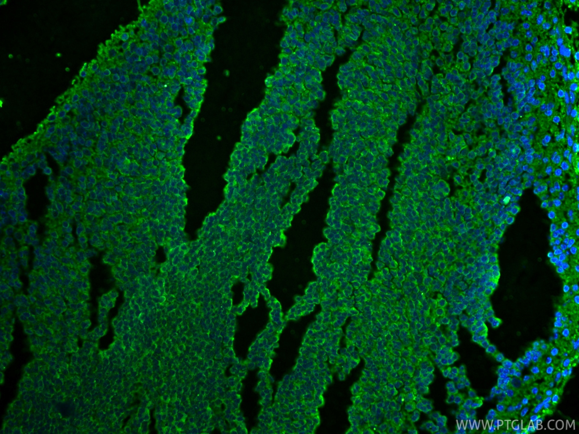 IF Staining of mouse embryo using 68773-1-Ig Immunofluorescence (IF) / fluorescent staining of mouse embryo tissue using Cleaved Caspase 3/P17/P19 Monoclonal antibody (68773-1-Ig)