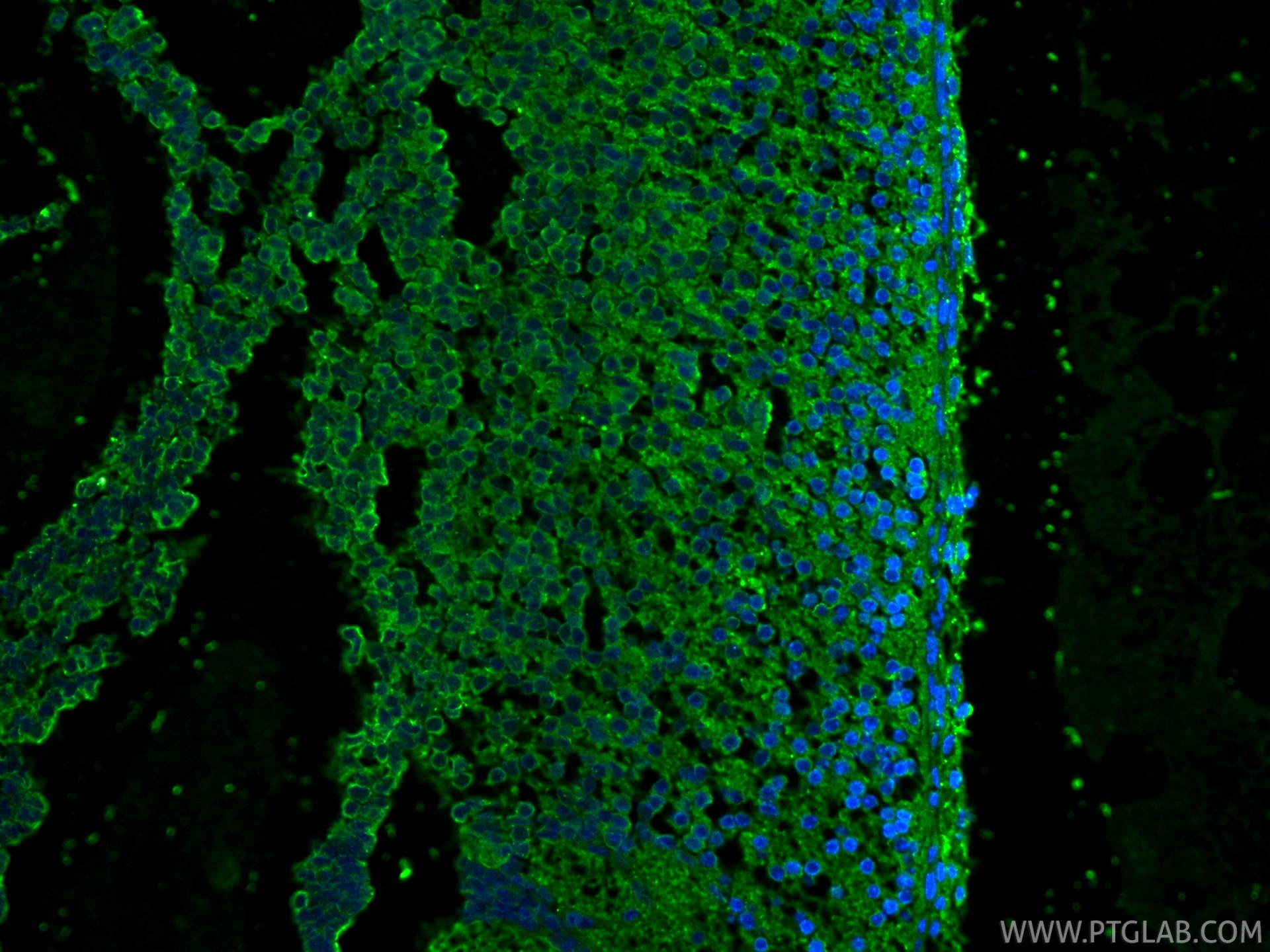 IF Staining of mouse embryo using 68773-1-Ig Immunofluorescence (IF) / fluorescent staining of mouse embryo tissue using Cleaved Caspase 3/P17/P19 Monoclonal antibody (68773-1-Ig)