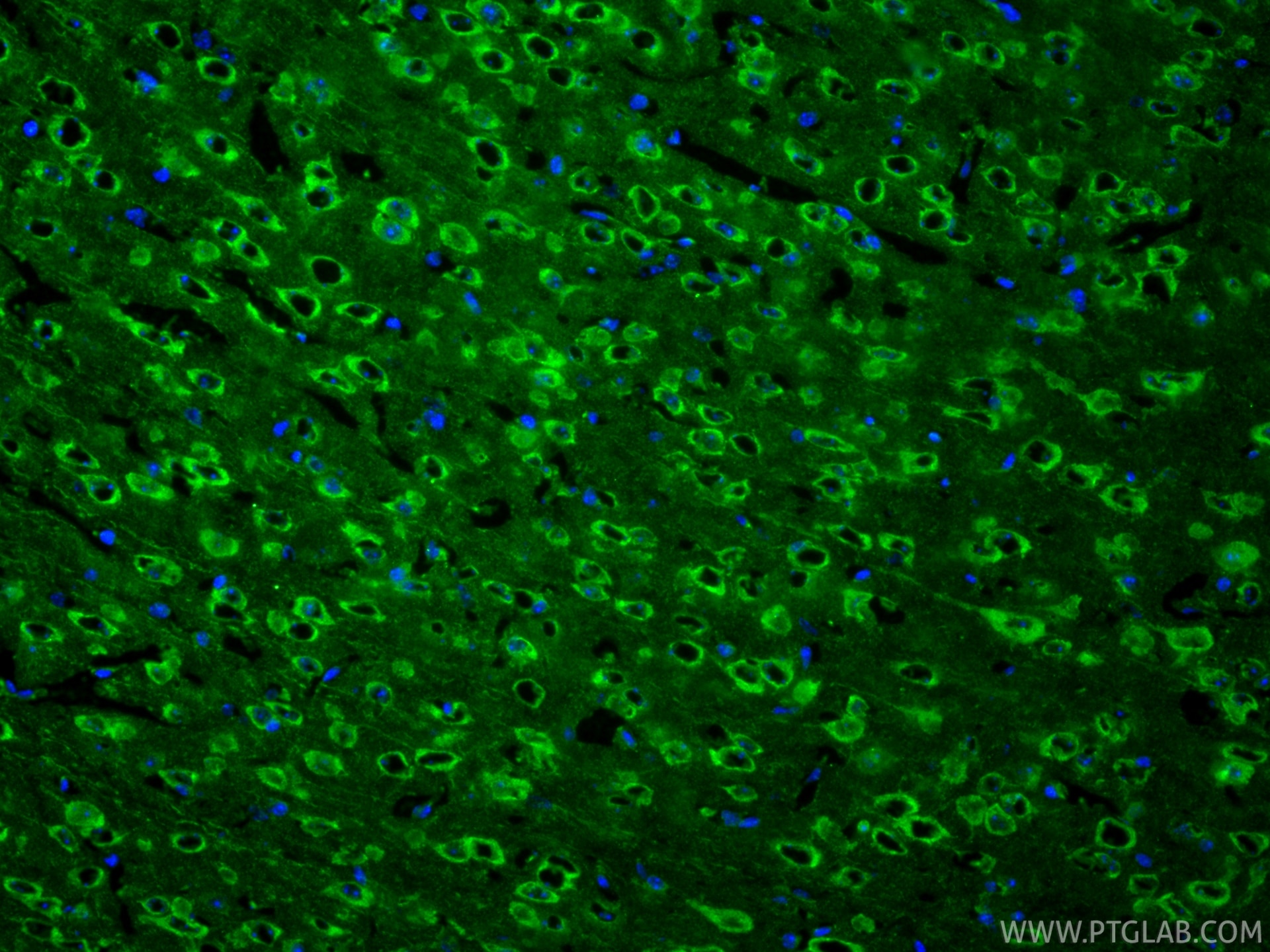 IF Staining of mouse brain using 68773-1-Ig Immunofluorescence (IF) / fluorescent staining of mouse brain tissue using Cleaved Caspase 3/P17/P19 Monoclonal antibody (68773-1-Ig)