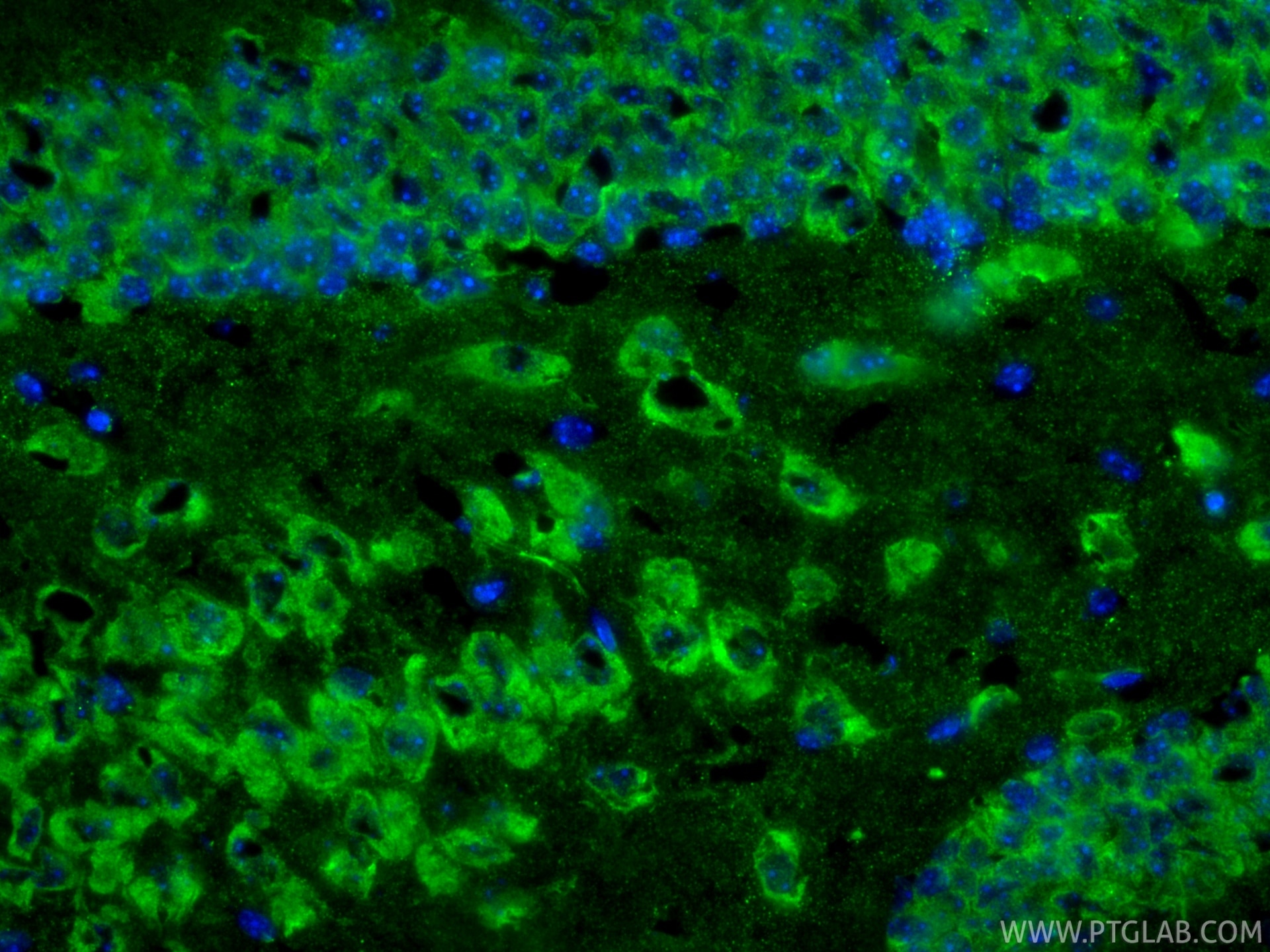 IF Staining of mouse brain using 68773-1-Ig Immunofluorescence (IF) / fluorescent staining of mouse brain tissue using Cleaved Caspase 3/P17/P19 Monoclonal antibody (68773-1-Ig)