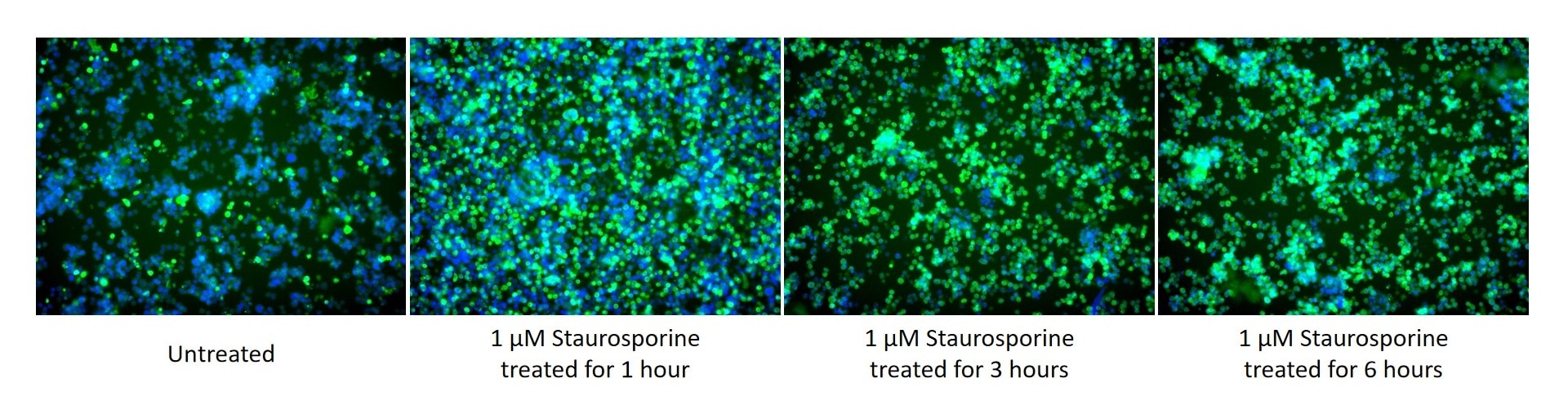 Immunofluorescence (IF) / fluorescent staining of Jurkat cells using Cleaved Caspase 3; p17 Monoclonal antibody (68773-1-Ig)