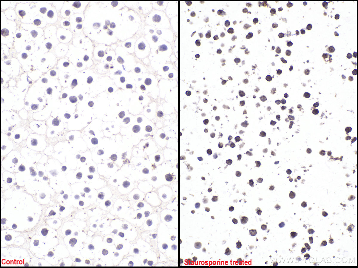 Immunohistochemistry (IHC) staining of Jurkat cells using Cleaved Caspase 3/P17/P19 Monoclonal antibody (68773-1-Ig)