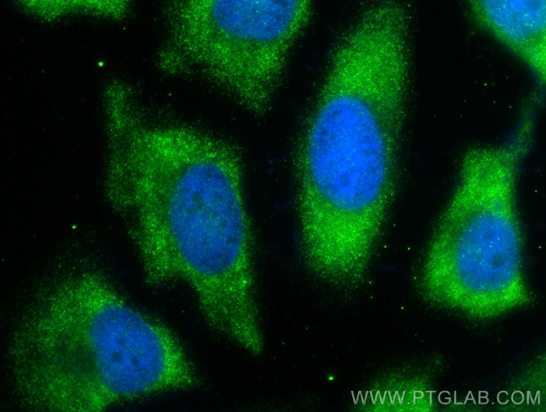Immunofluorescence (IF) / fluorescent staining of HeLa cells using Multi-rAb™ Cleaved Caspase 3/P17/P19 Multi-Recombi (RMX00003)