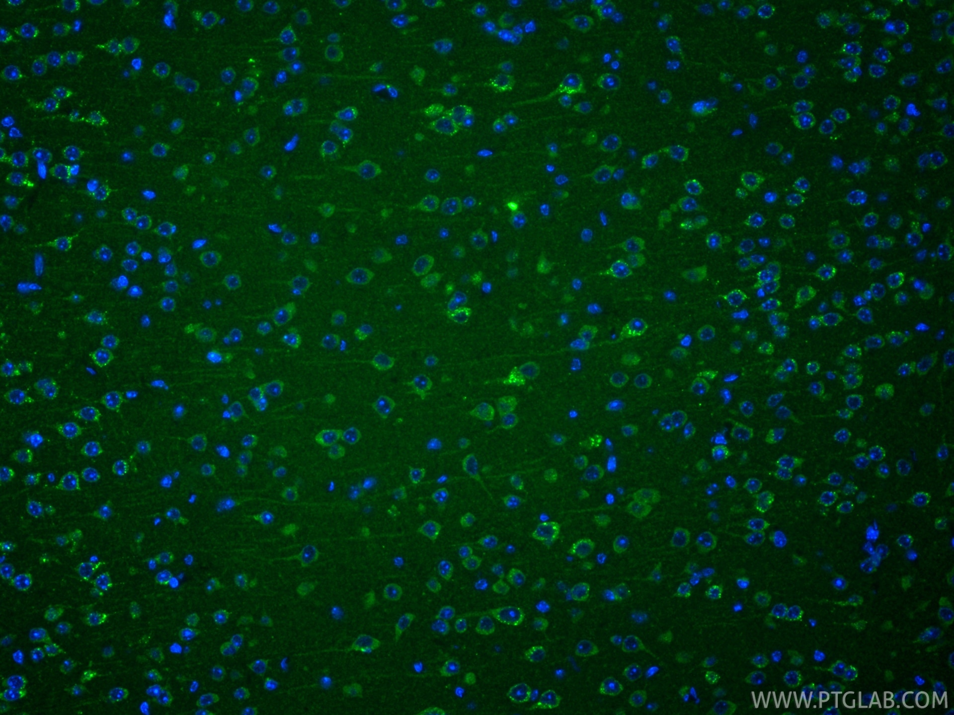 IF Staining of mouse brain using RMX00003 Immunofluorescence (IF) / fluorescent staining of mouse brain tissue using Multi-rAb® Cleaved Caspase 3/P17/P19 Multi-Recombi (RMX00003)
