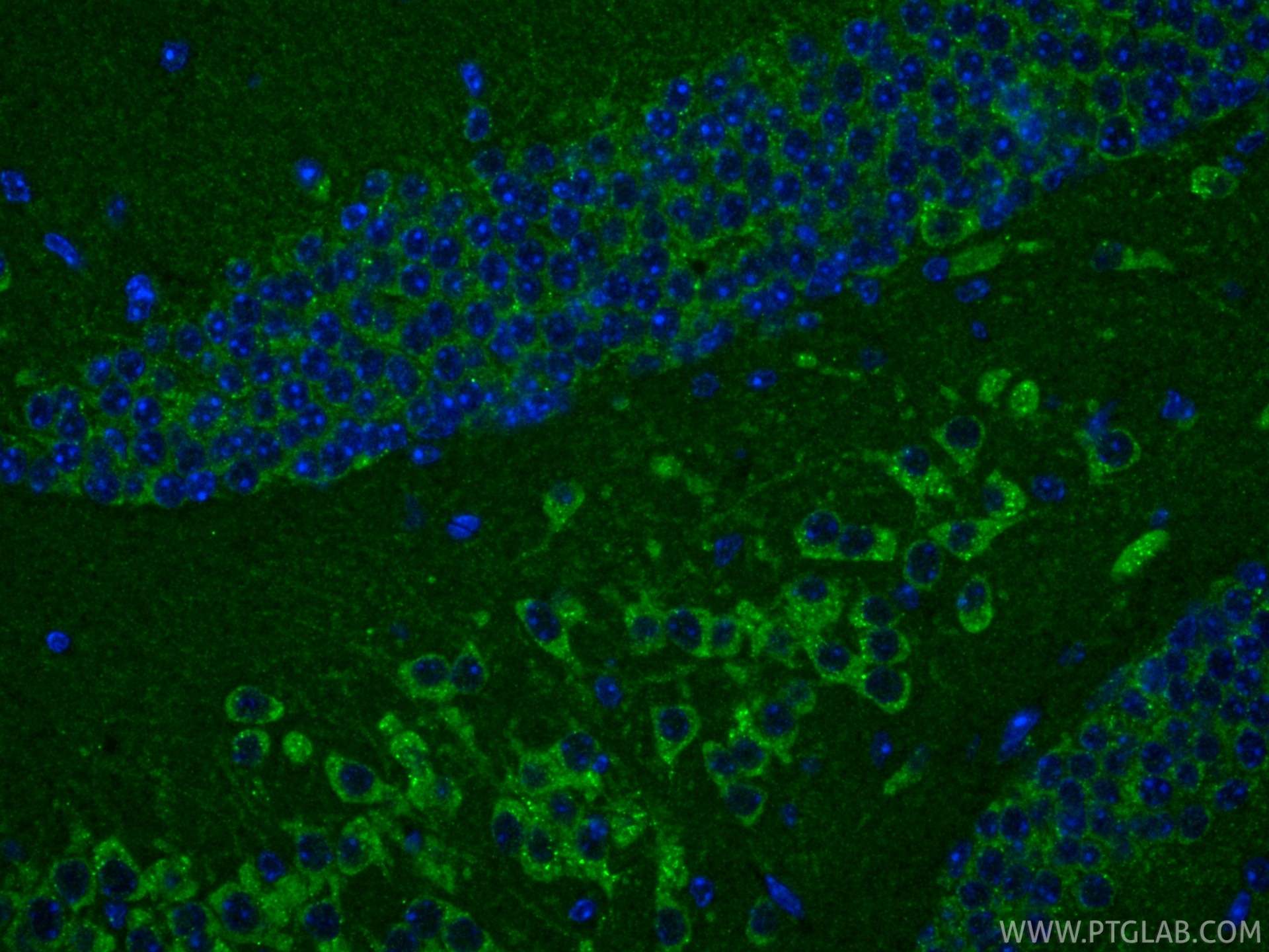 IF Staining of mouse brain using RMX00003 Immunofluorescence (IF) / fluorescent staining of mouse brain tissue using Multi-rAb® Cleaved Caspase 3/P17/P19 Multi-Recombi (RMX00003)