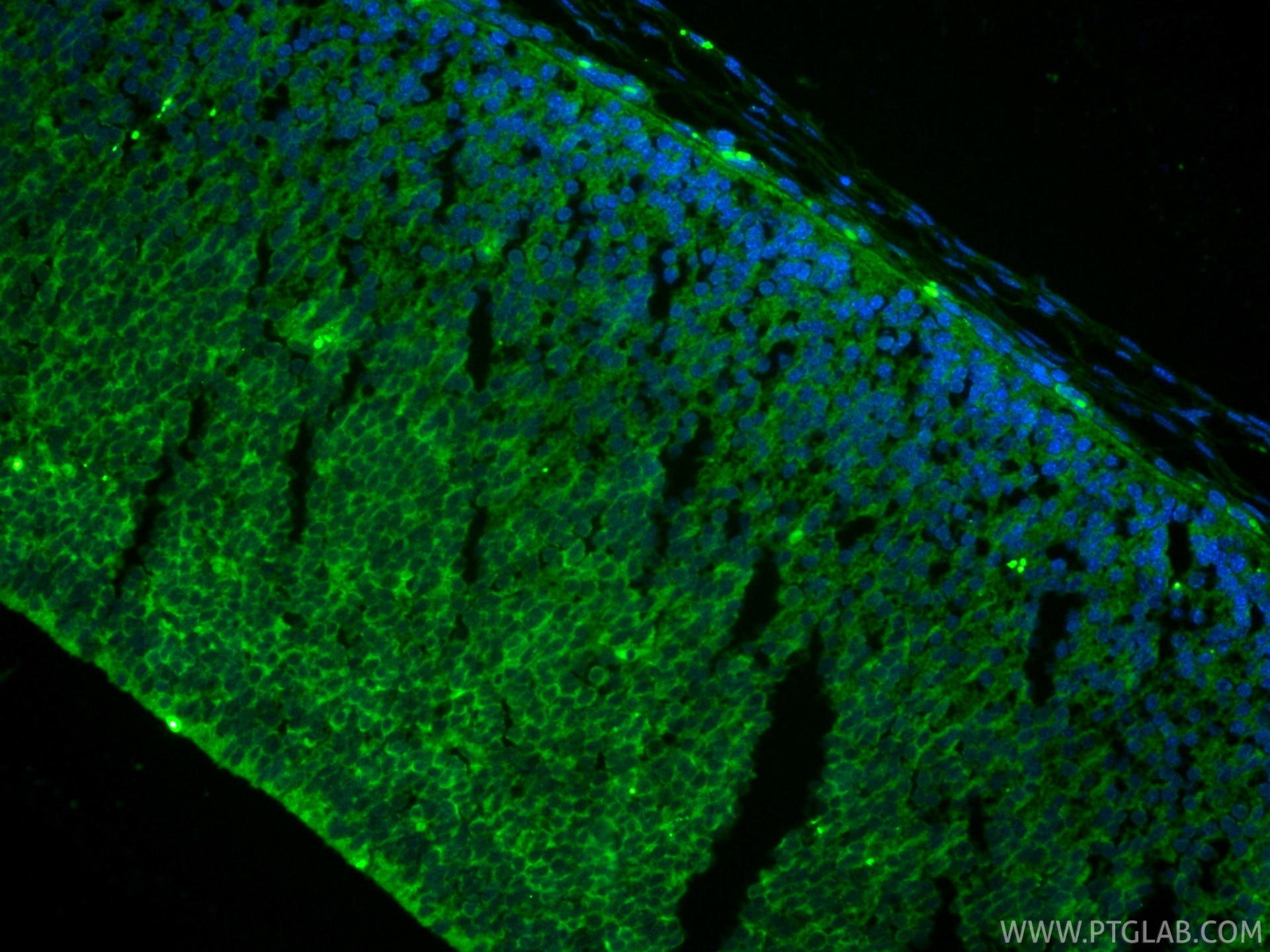 IF Staining of mouse embryo using RMX00003 Immunofluorescence (IF) / fluorescent staining of mouse embryo tissue using Multi-rAb® Cleaved Caspase 3/P17/P19 Multi-Recombi (RMX00003)