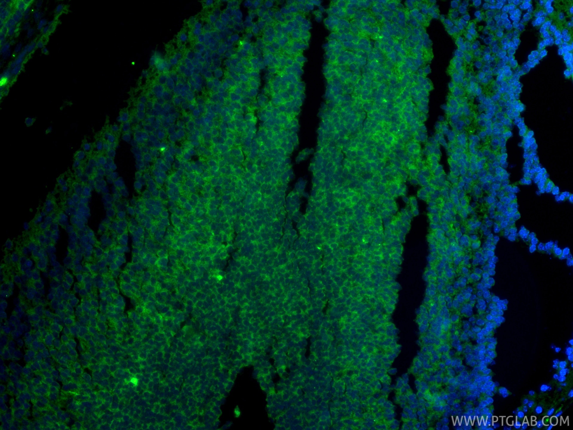IF Staining of mouse embryo using RMX00003 Immunofluorescence (IF) / fluorescent staining of mouse embryo tissue using Multi-rAb® Cleaved Caspase 3/P17/P19 Multi-Recombi (RMX00003)
