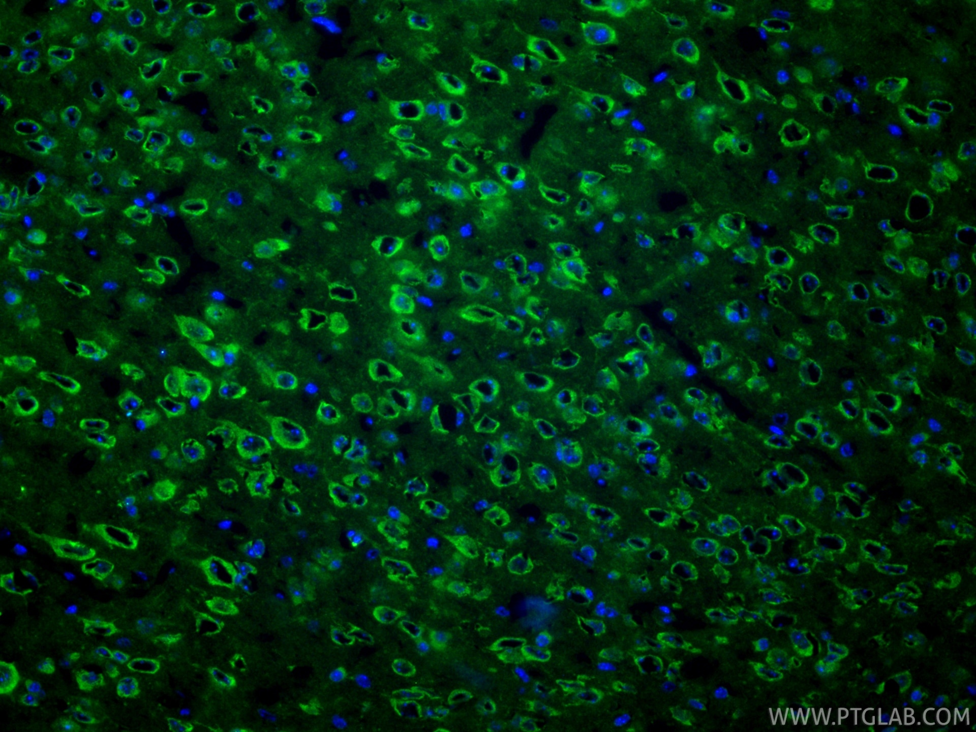 IF Staining of mouse brain using RMX00003 Immunofluorescence (IF) / fluorescent staining of mouse brain tissue using Multi-rAb® Cleaved Caspase 3/P17/P19 Multi-Recombi (RMX00003)
