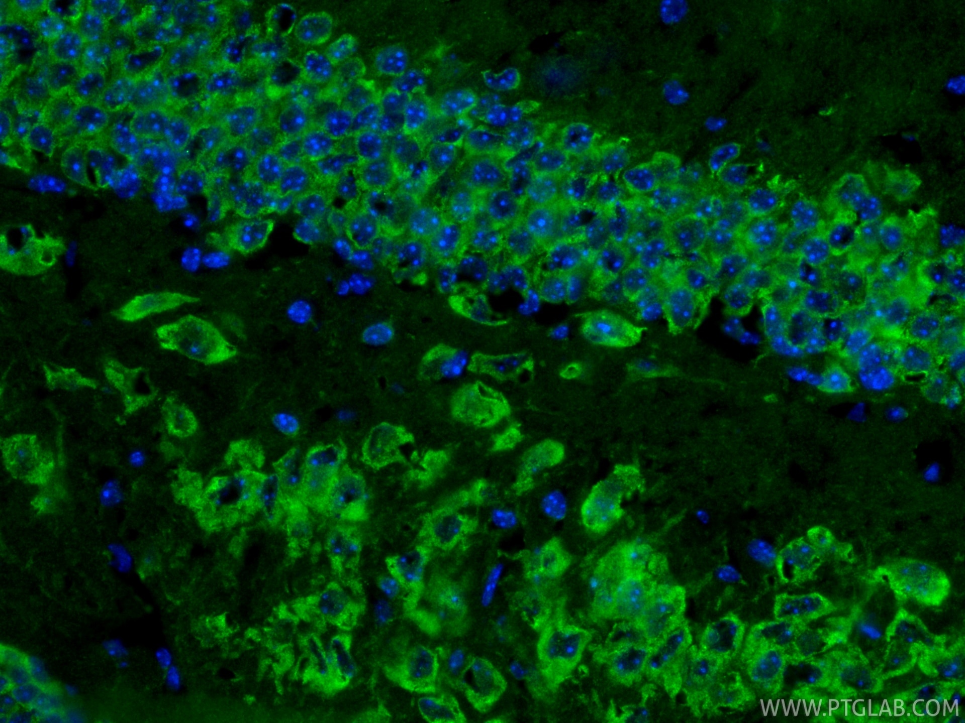 IF Staining of mouse brain using RMX00003 Immunofluorescence (IF) / fluorescent staining of mouse brain tissue using Multi-rAb® Cleaved Caspase 3/P17/P19 Multi-Recombi (RMX00003)