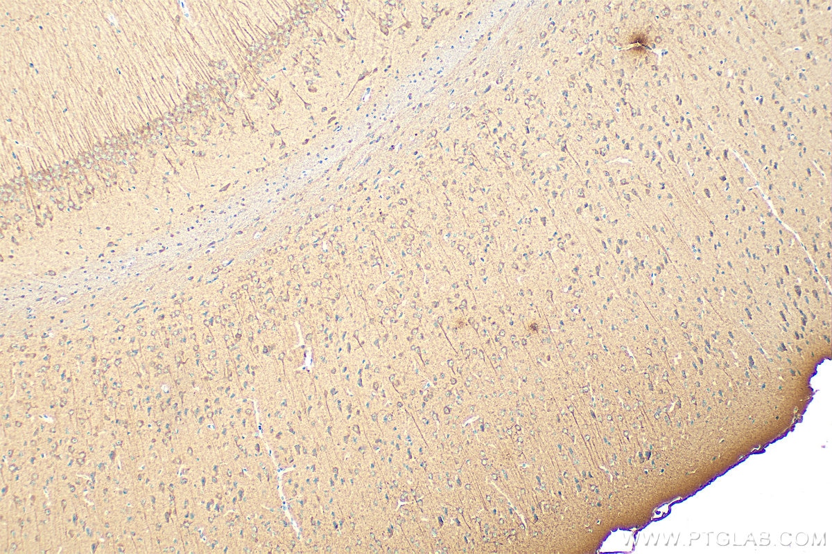 Immunohistochemistry (IHC) staining of mouse brain tissue using Multi-rAb™ Cleaved Caspase 3/P17/P19 Multi-Recombi (RMX00003)