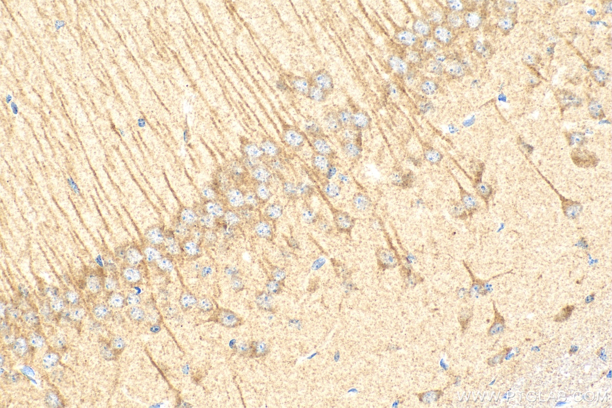 Cleaved Caspase 3/P17/P19