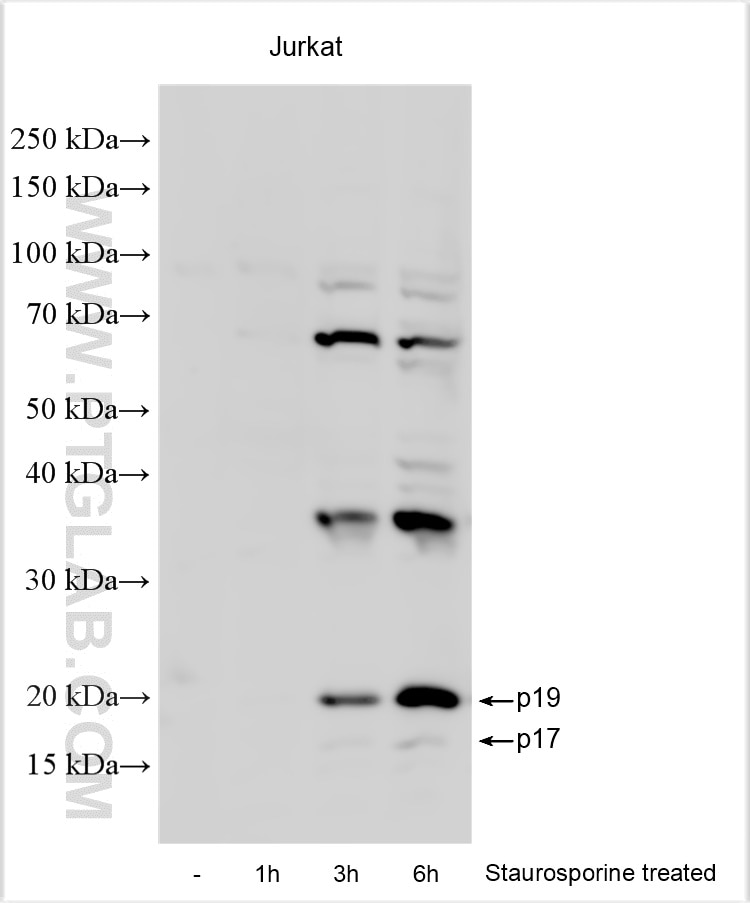 Western Blot (WB) analysis of Jurkat cells using Multi-rAb™ Cleaved Caspase 3/P17/P19 Multi-Recombi (RMX00003)