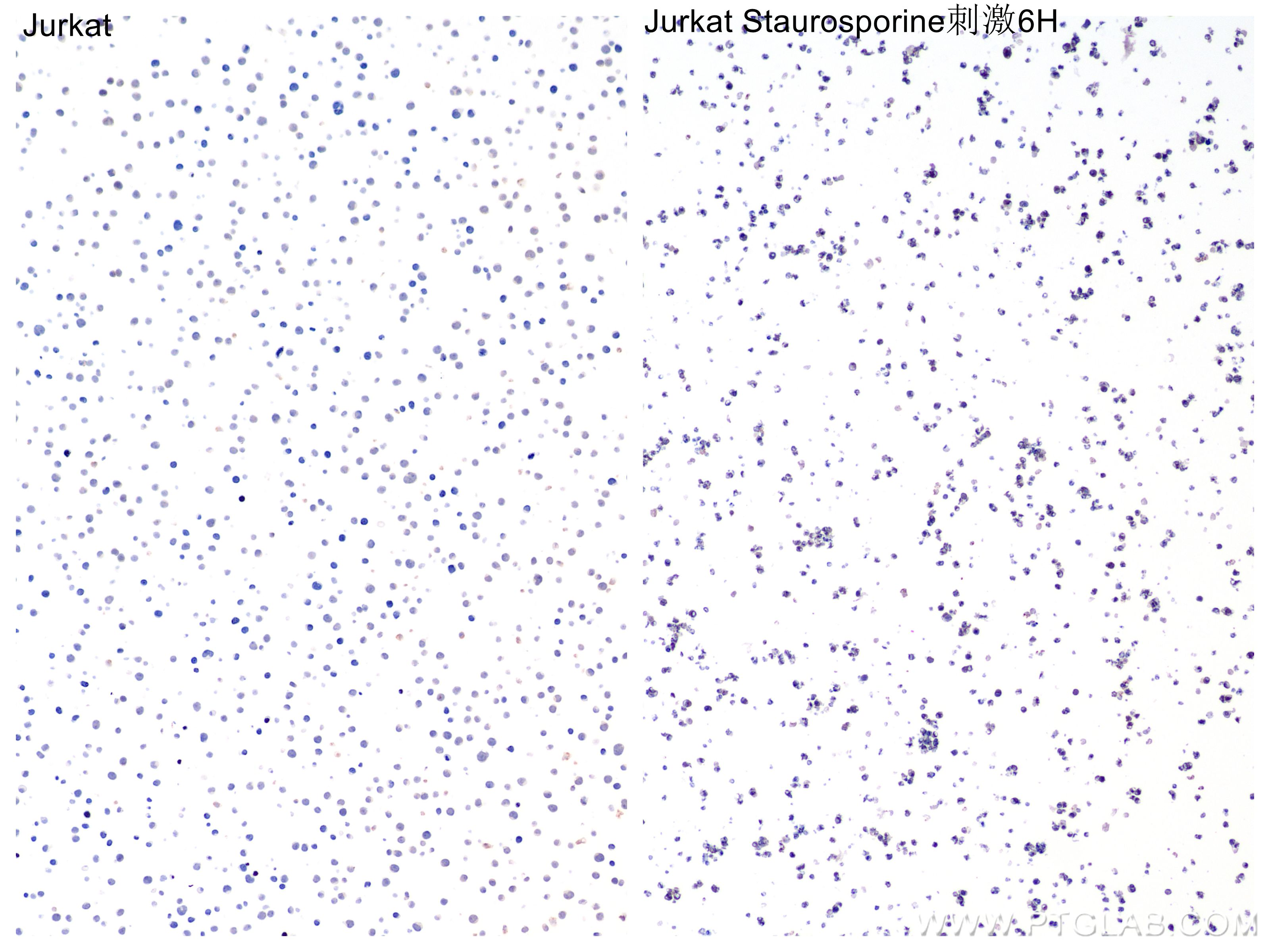 Immunohistochemistry (IHC) staining of Jurkat cells using Cleaved Caspase 7 Recombinant monoclonal antibody (85328-1-RR)
