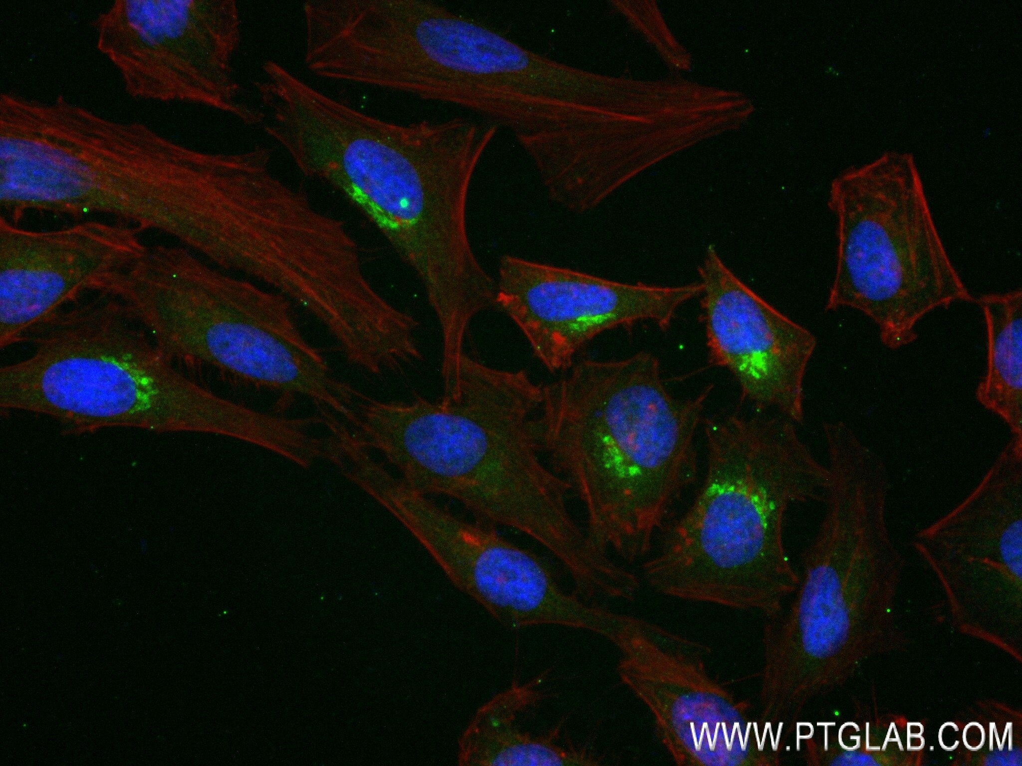 Immunofluorescence (IF) / fluorescent staining of HeLa cells using Clusterin Recombinant antibody (84067-5-RR)