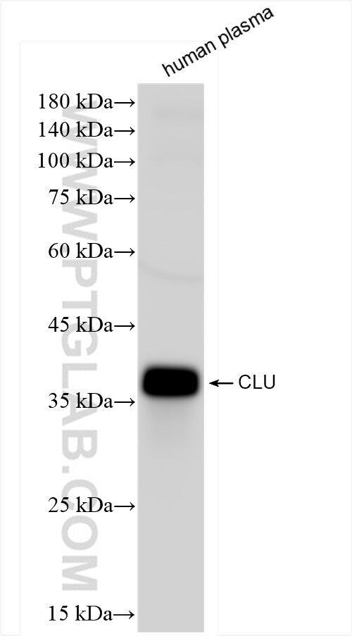Western Blot (WB) analysis of human plasma using Clusterin Recombinant antibody (84067-5-RR)