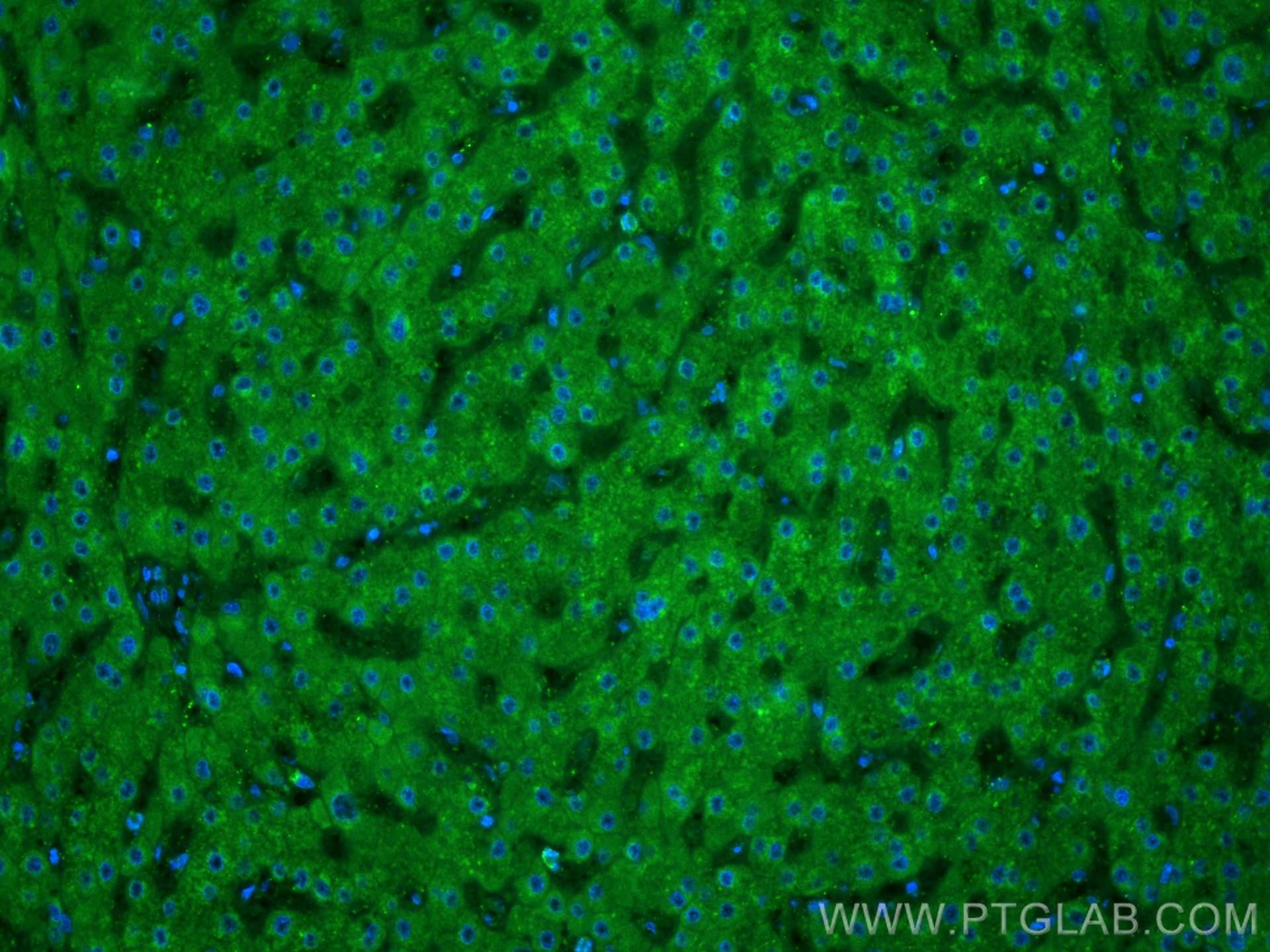 Immunofluorescence (IF) / fluorescent staining of human liver tissue using CoraLite® Plus 488-conjugated Clusterin Polyclonal (CL488-12289)
