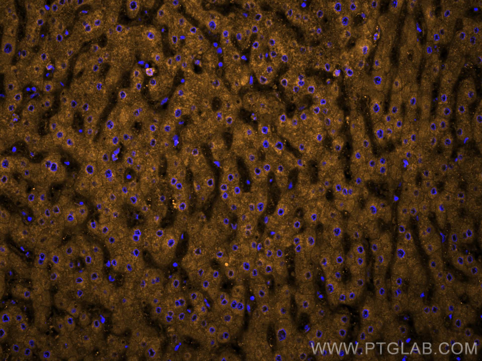 Immunofluorescence (IF) / fluorescent staining of human liver tissue using CoraLite®555-conjugated Clusterin Polyclonal antib (CL555-12289)