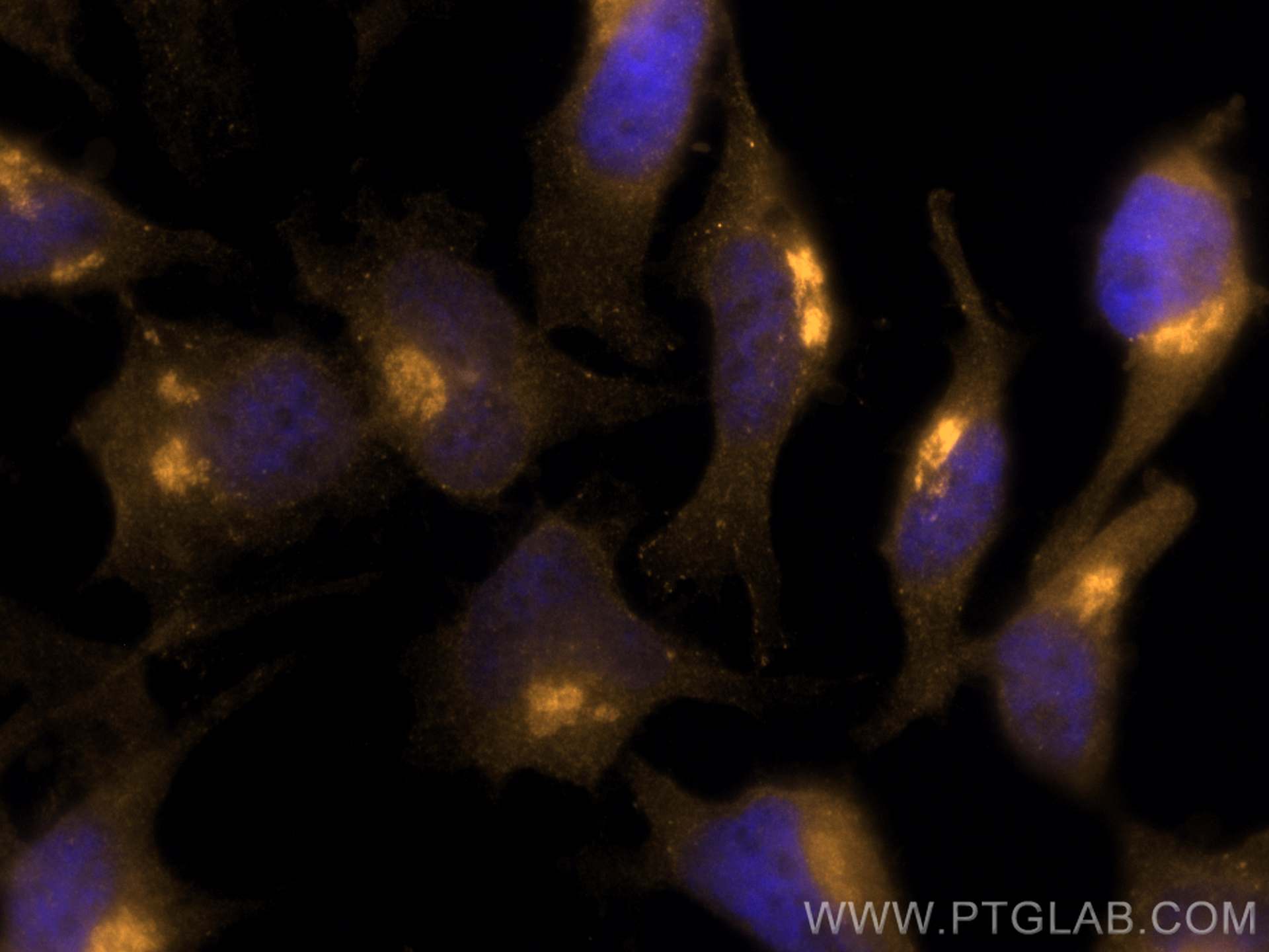 Immunofluorescence (IF) / fluorescent staining of HeLa cells using CoraLite®555-conjugated Clusterin Polyclonal antib (CL555-12289)
