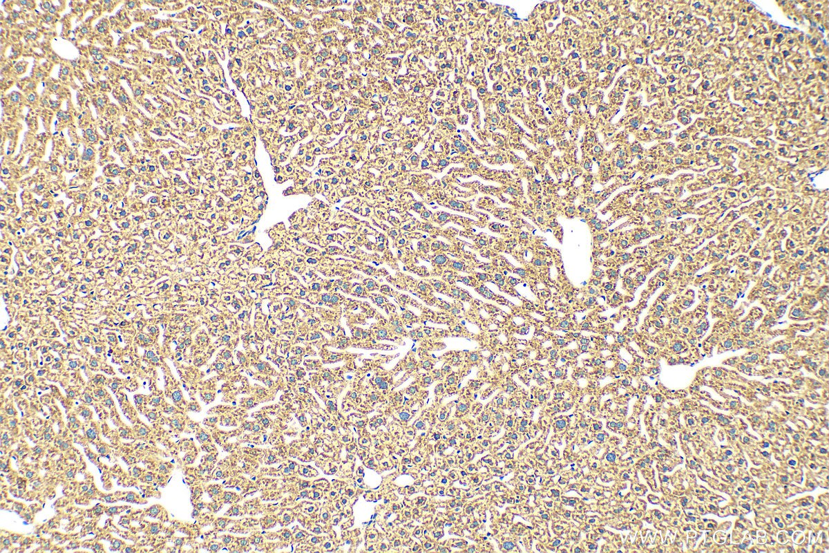 Immunohistochemistry (IHC) staining of mouse liver tissue using Coagulation Factor II Polyclonal antibody (31615-1-AP)