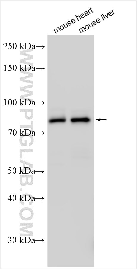 Western Blot (WB) analysis of various lysates using Coagulation Factor II Polyclonal antibody (31615-1-AP)