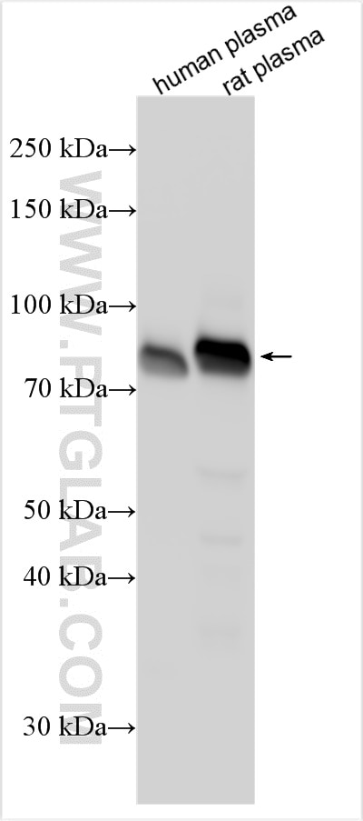Western Blot (WB) analysis of various lysates using Coagulation Factor II Polyclonal antibody (31615-1-AP)