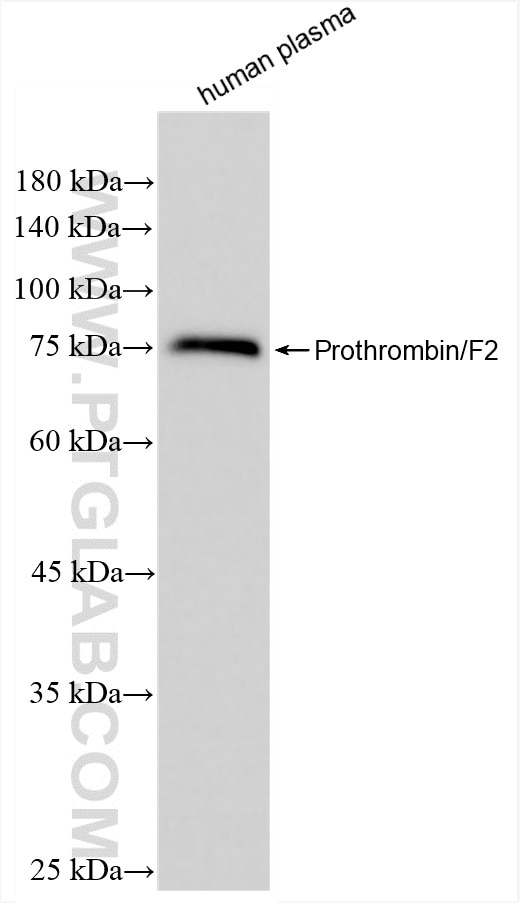 Coagulation factor II