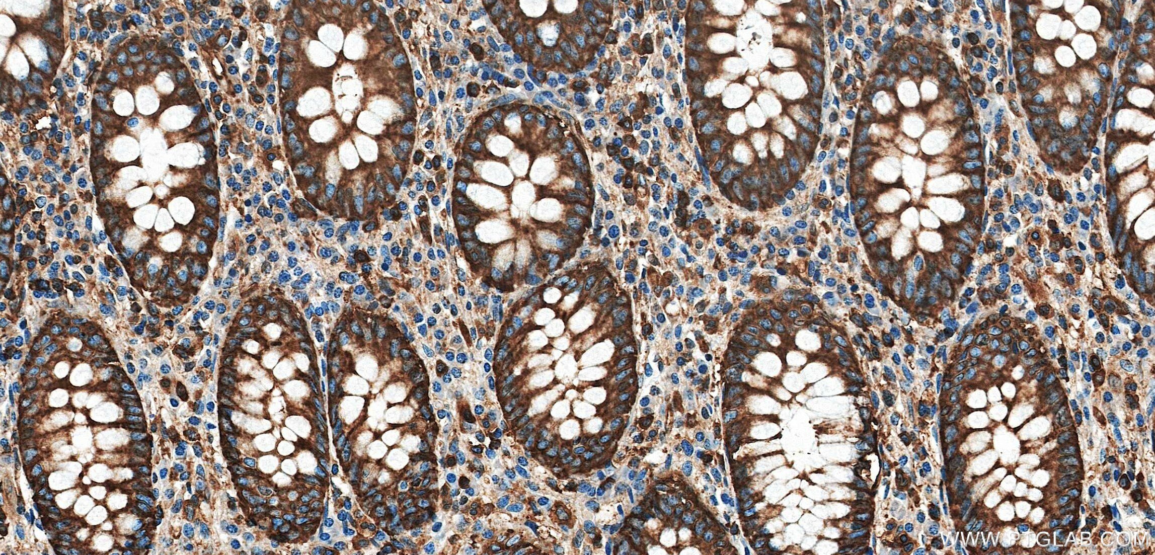 Immunohistochemistry (IHC) staining of human appendix tissue using Cofilin Recombinant monoclonal antibody (88053-1-RR)