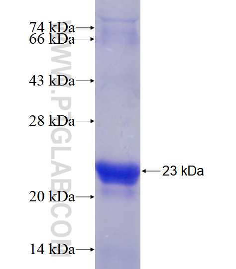 Cofilin fusion protein Ag18044 SDS-PAGE