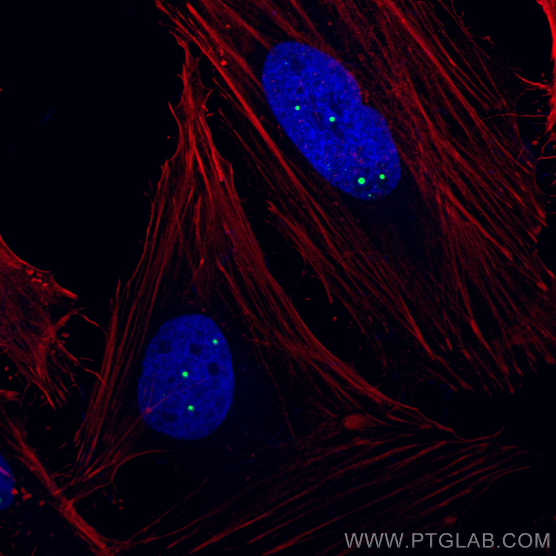 Immunofluorescence (IF) / fluorescent staining of HeLa cells using CoraLite® Plus 488-conjugated Coilin Polyclonal an (CL488-10967)