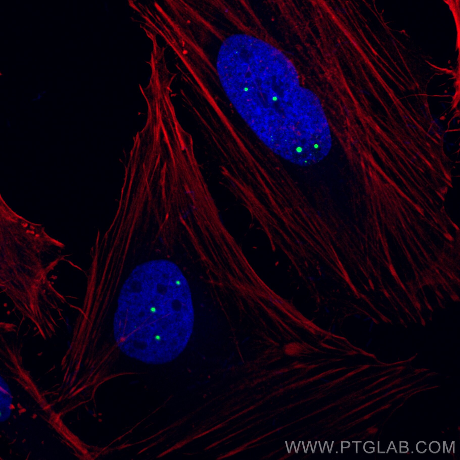 IF Staining of HeLa using CL488-10967