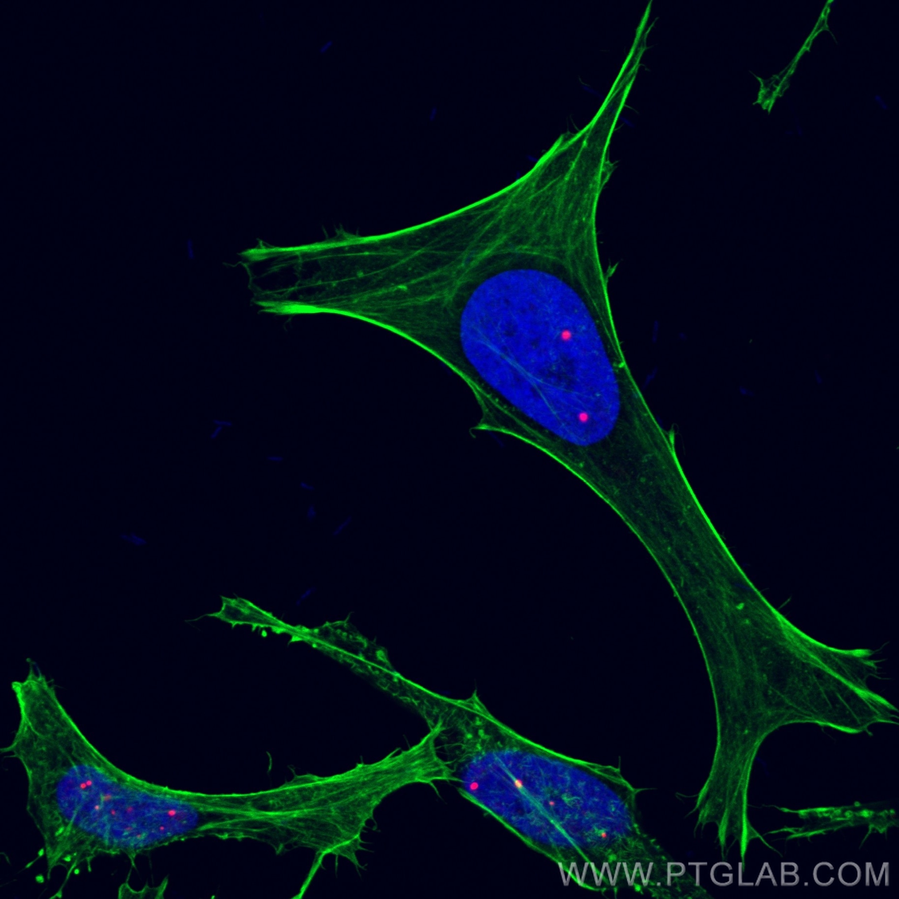 Immunofluorescence (IF) / fluorescent staining of HeLa cells using CoraLite®594-conjugated Coilin Polyclonal antibody (CL594-10967)