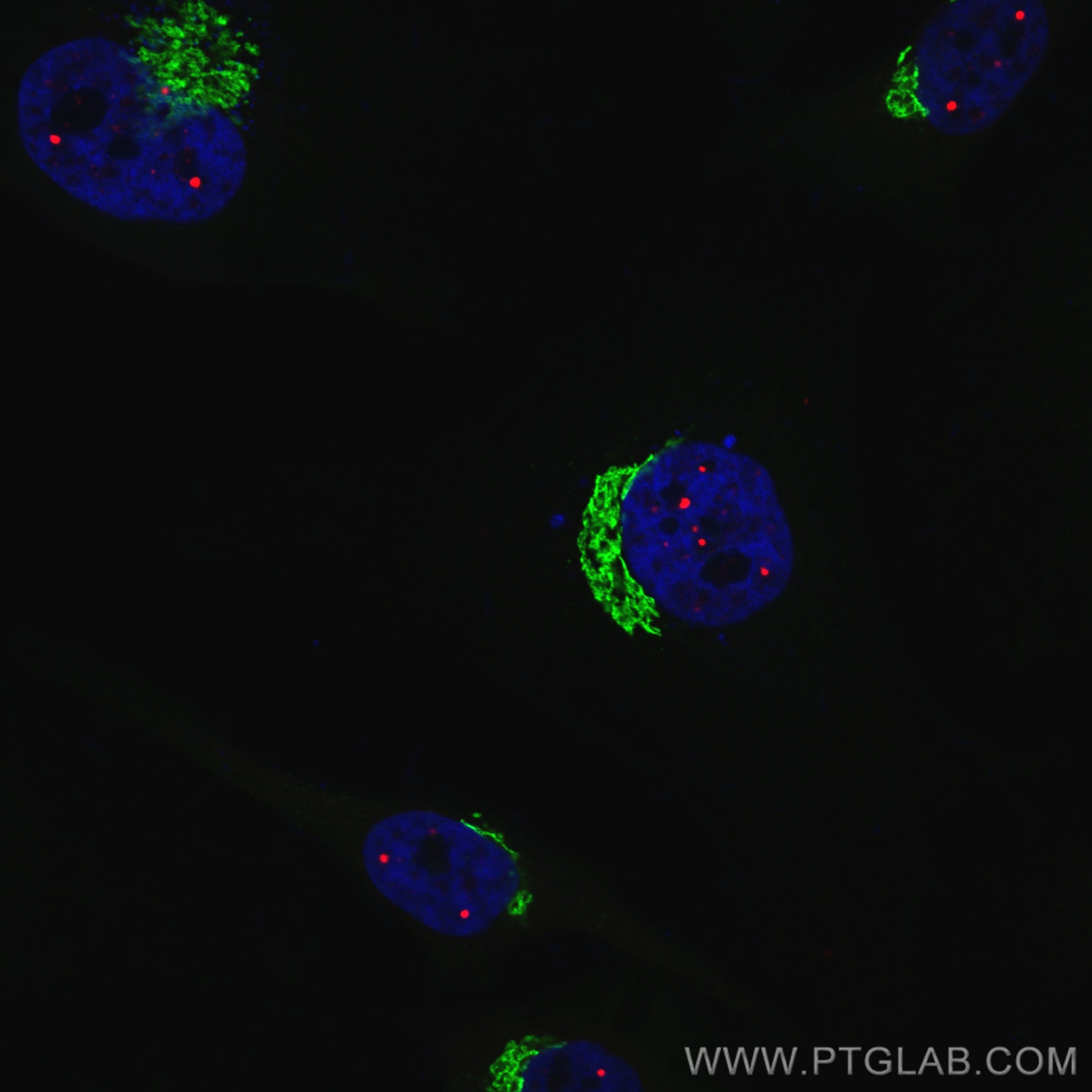 Immunofluorescence (IF) / fluorescent staining of HeLa cells using CoraLite®594-conjugated Coilin Polyclonal antibody (CL594-10967)