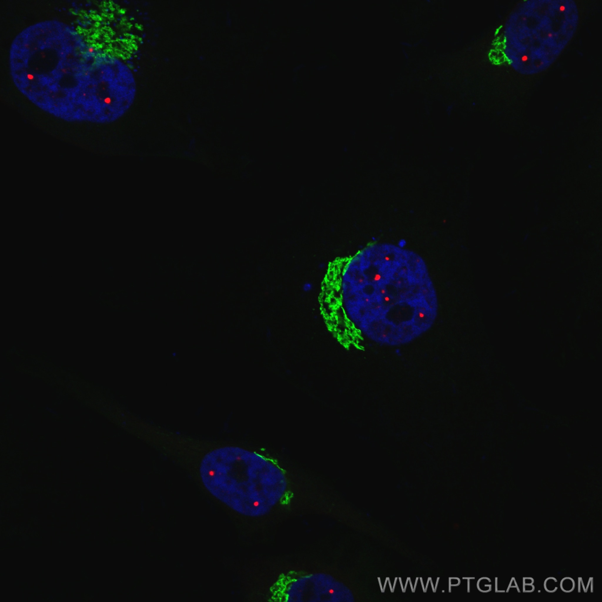 IF Staining of HeLa using CL594-10967