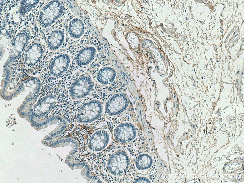 Immunohistochemistry (IHC) staining of human colon tissue using Collagen Type I Monoclonal antibody (67288-1-Ig)
