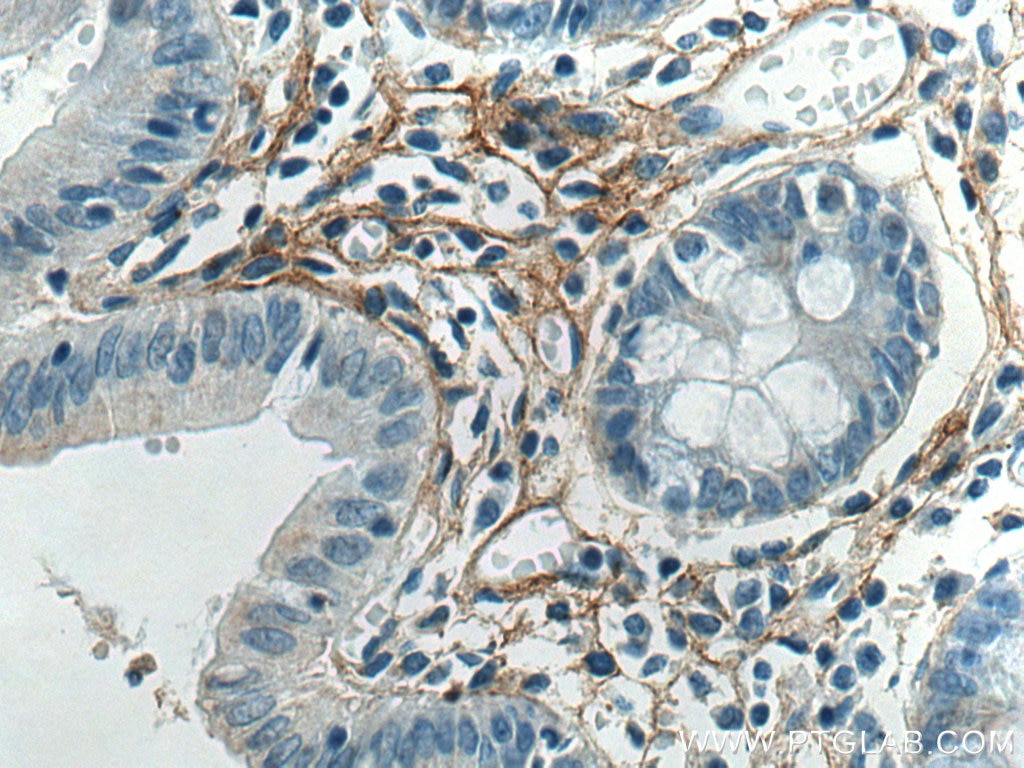 Immunohistochemistry (IHC) staining of human colon tissue using Collagen Type I Monoclonal antibody (67288-1-Ig)