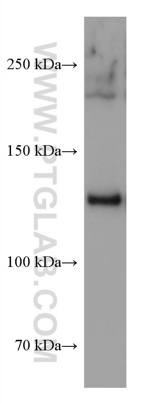 Western Blot (WB) analysis of human placenta tissue using Collagen Type I Monoclonal antibody (67288-1-Ig)